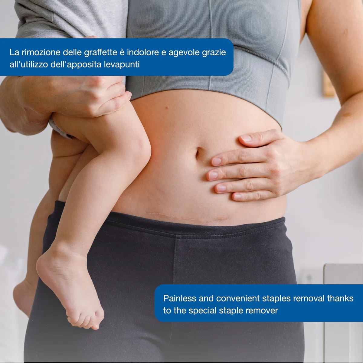 Gima Agrafeuse Cutanee Sterile pour Incisions, 5 Pièce