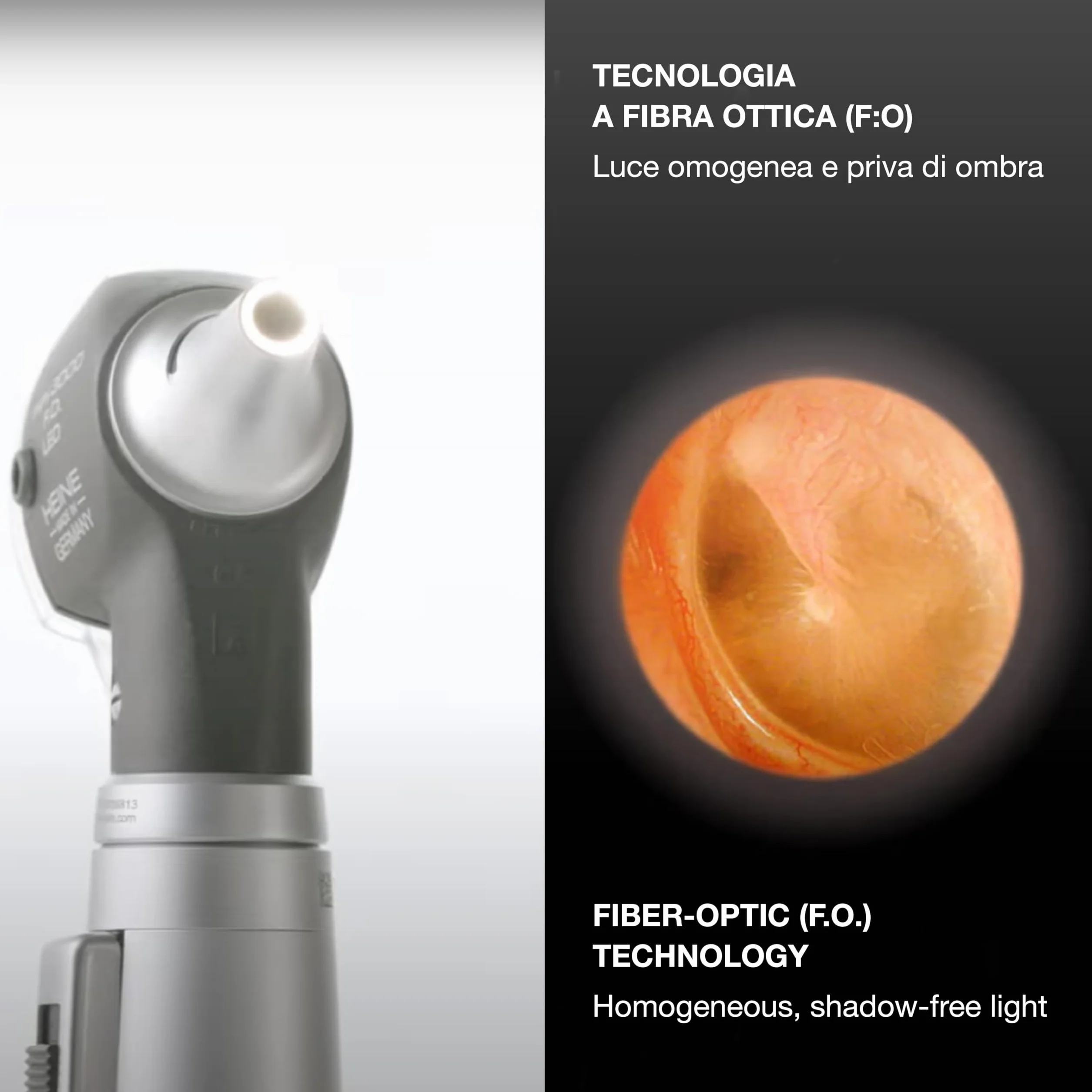 Heine Mini 3000 Otoscope F.O. LED, noir, avec étui